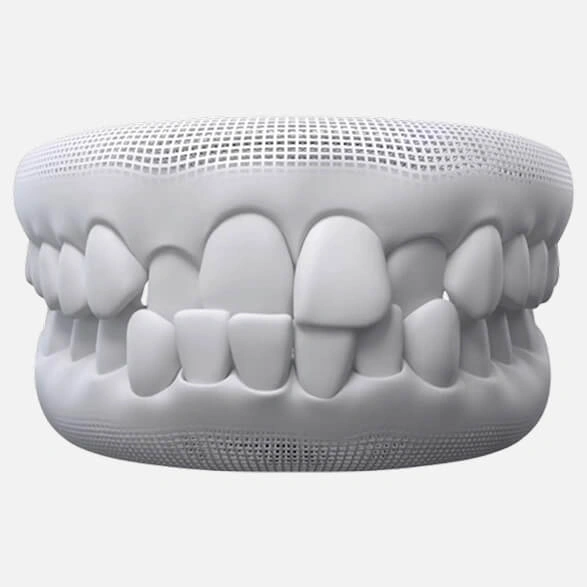 Crossbite