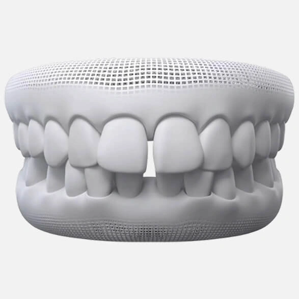 Gapped teeth