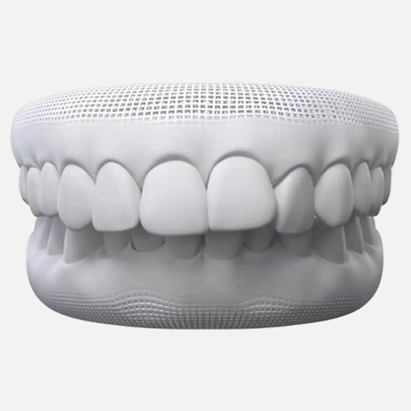 Overbite