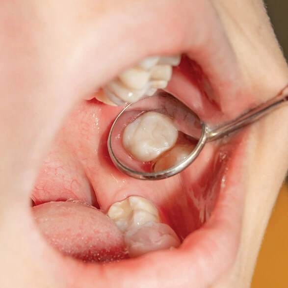 Restorative Dentistry